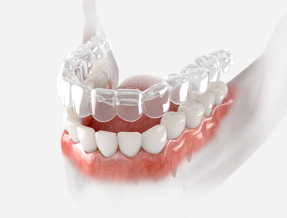 Czym jest korona protetyczna?